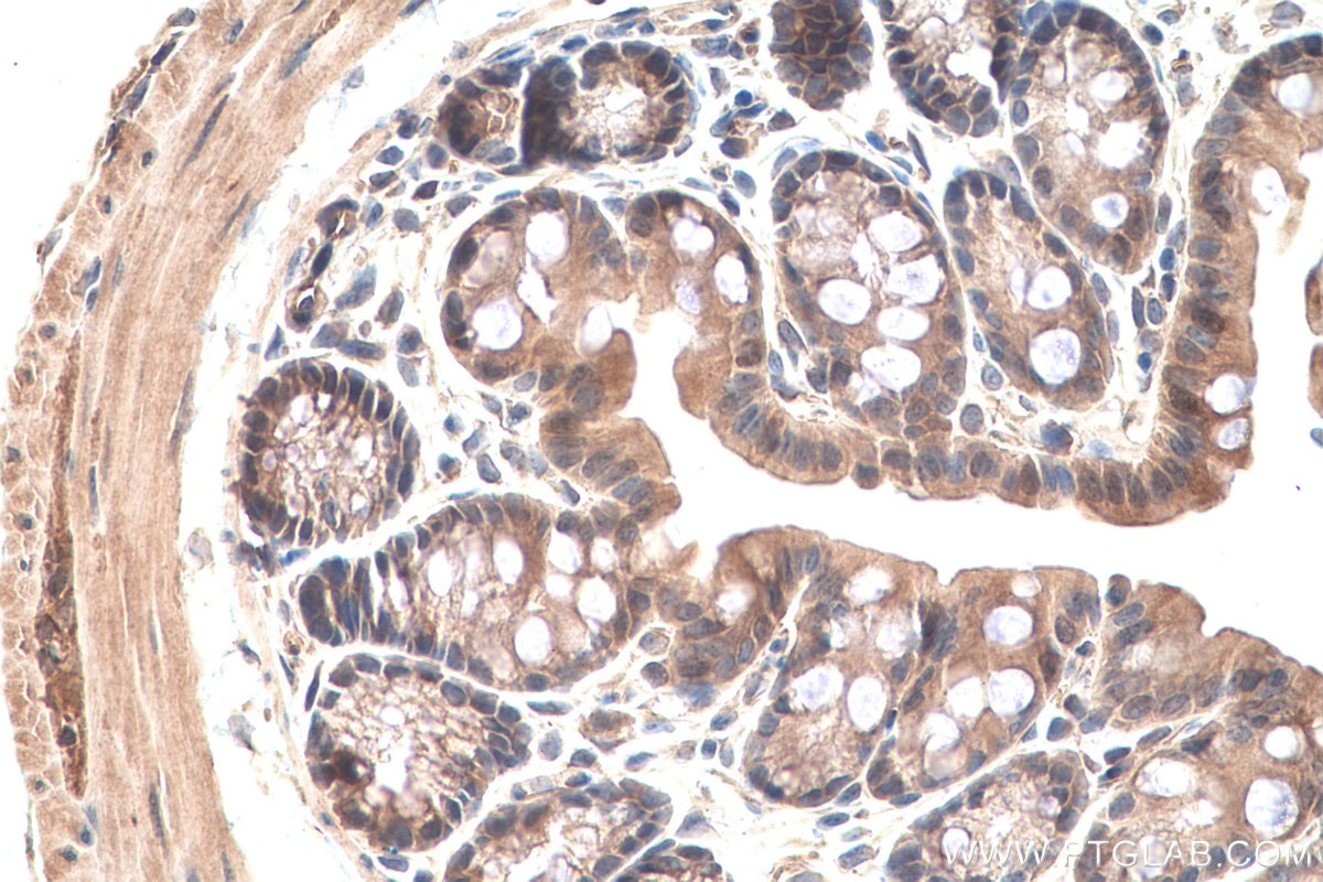 Immunohistochemical analysis of paraffin-embedded mouse colon tissue slide using KHC0808 (Amphiregulin IHC Kit).