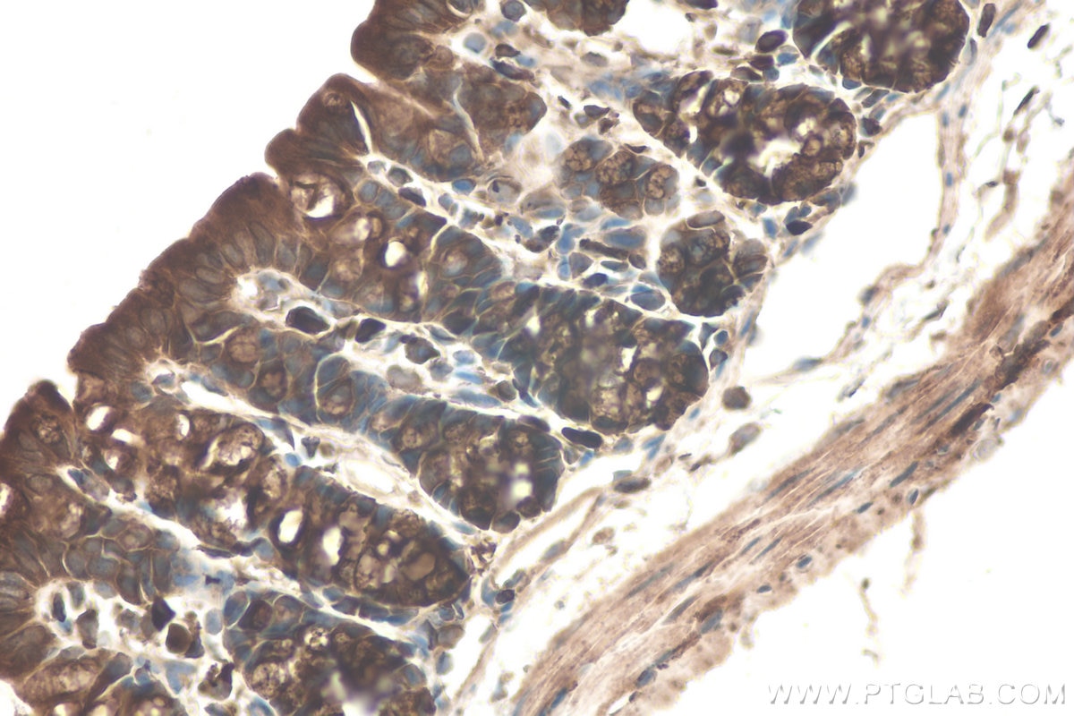 Immunohistochemical analysis of paraffin-embedded mouse colon tissue slide using KHC0712 (ARF1 IHC Kit).