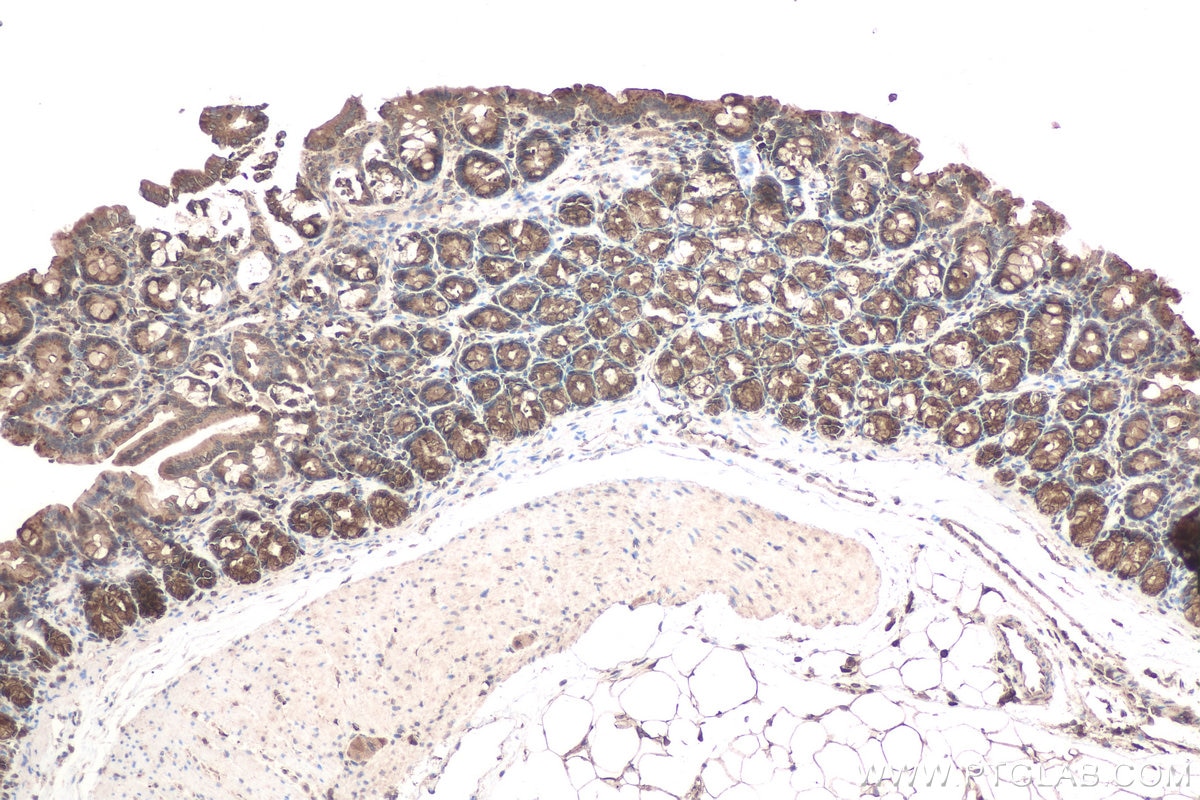 Immunohistochemical analysis of paraffin-embedded rat colon tissue slide using KHC0712 (ARF1 IHC Kit).