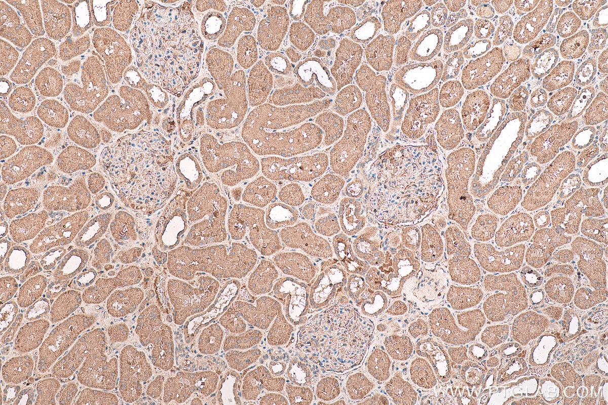 Immunohistochemical analysis of paraffin-embedded human kidney tissue slide using KHC0713 (ARF3 IHC Kit).