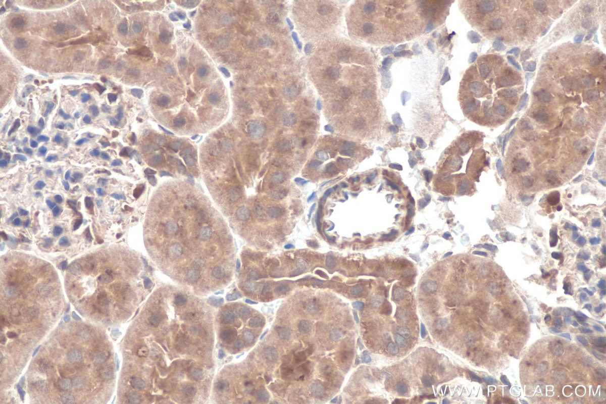 Immunohistochemical analysis of paraffin-embedded rat kidney tissue slide using KHC0713 (ARF3 IHC Kit).