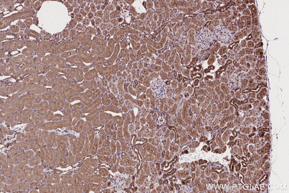 Immunohistochemical analysis of paraffin-embedded rat kidney tissue slide using KHC2679 (ARFGAP2 IHC Kit).
