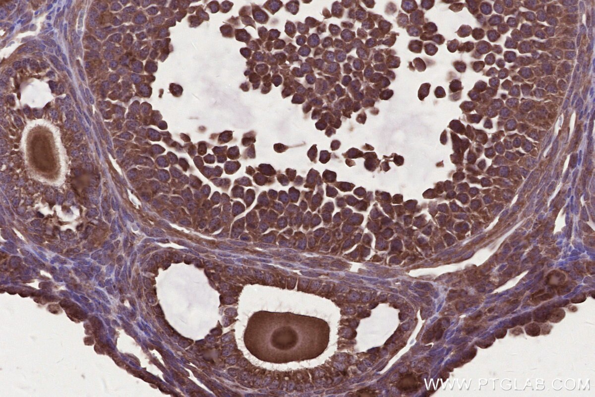 Immunohistochemical analysis of paraffin-embedded mouse ovary tissue slide using KHC2679 (ARFGAP2 IHC Kit).