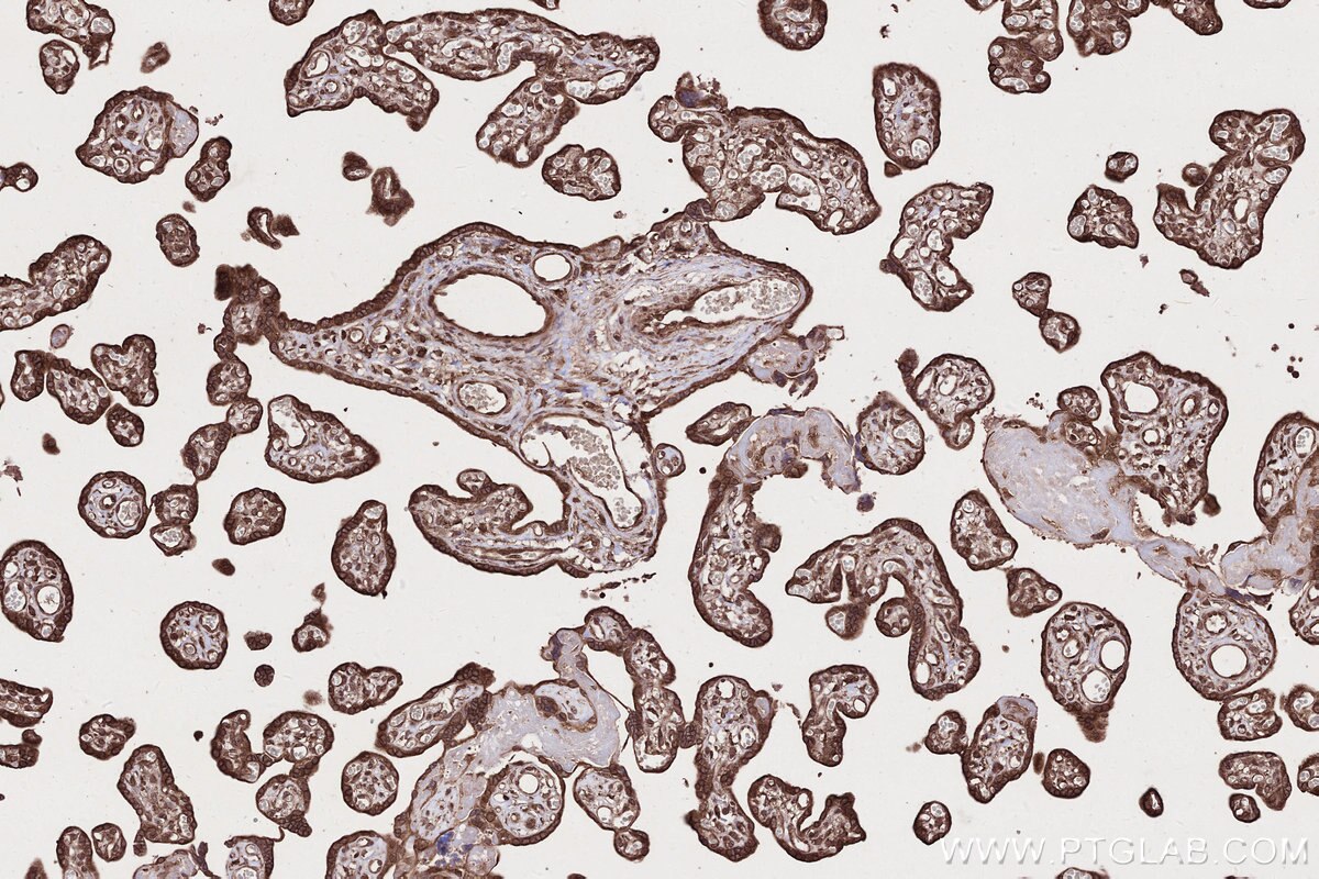 Immunohistochemical analysis of paraffin-embedded human placenta tissue slide using KHC2679 (ARFGAP2 IHC Kit).