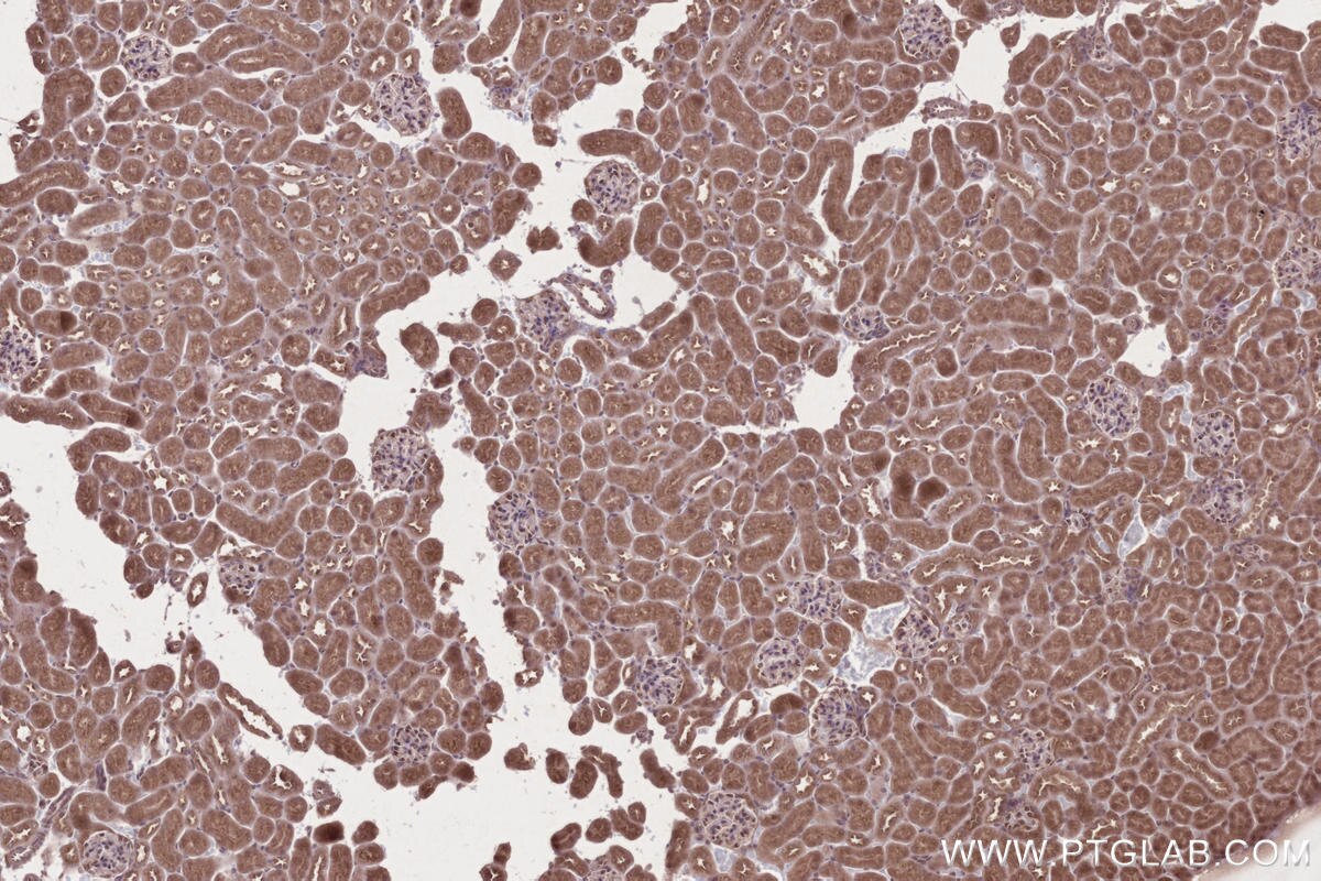 Immunohistochemical analysis of paraffin-embedded mouse kidney tissue slide using KHC2679 (ARFGAP2 IHC Kit).