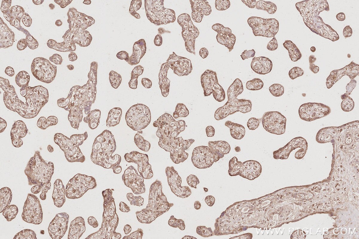 Immunohistochemical analysis of paraffin-embedded human placenta tissue slide using KHC3087 (ARFGEF2 IHC Kit). Immunohistochemical analysis of paraffin-embedded human placenta tissue slide using KHC3087 (ARFGEF2 IHC Kit).