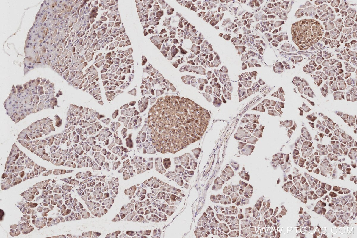 Immunohistochemical analysis of paraffin-embedded mouse pancreas tissue slide using KHC3087 (ARFGEF2 IHC Kit). Immunohistochemical analysis of paraffin-embedded mouse pancreas tissue slide using KHC3087 (ARFGEF2 IHC Kit).