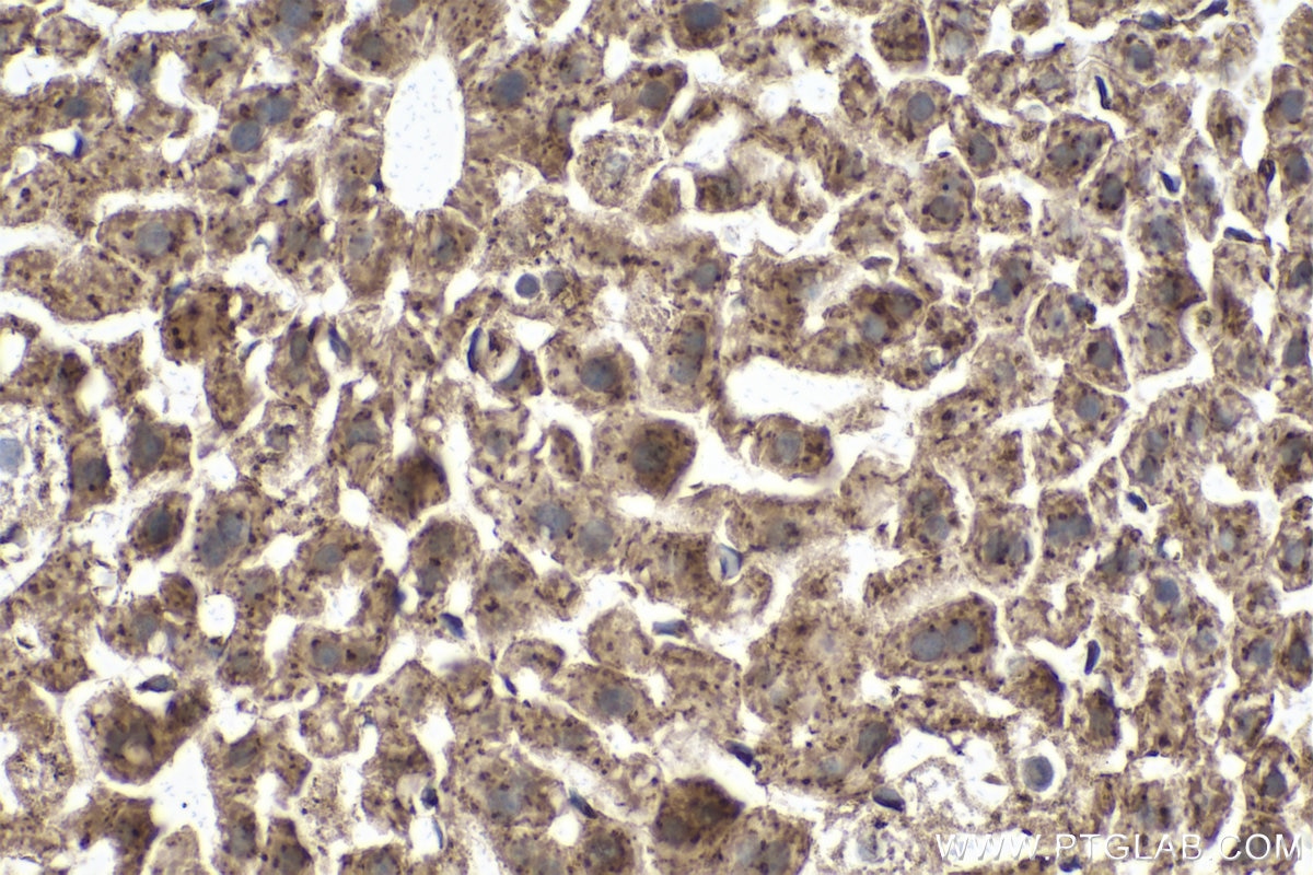 Immunohistochemical analysis of paraffin-embedded mouse liver tissue slide using KHC0865 (ARFIP1 IHC Kit).