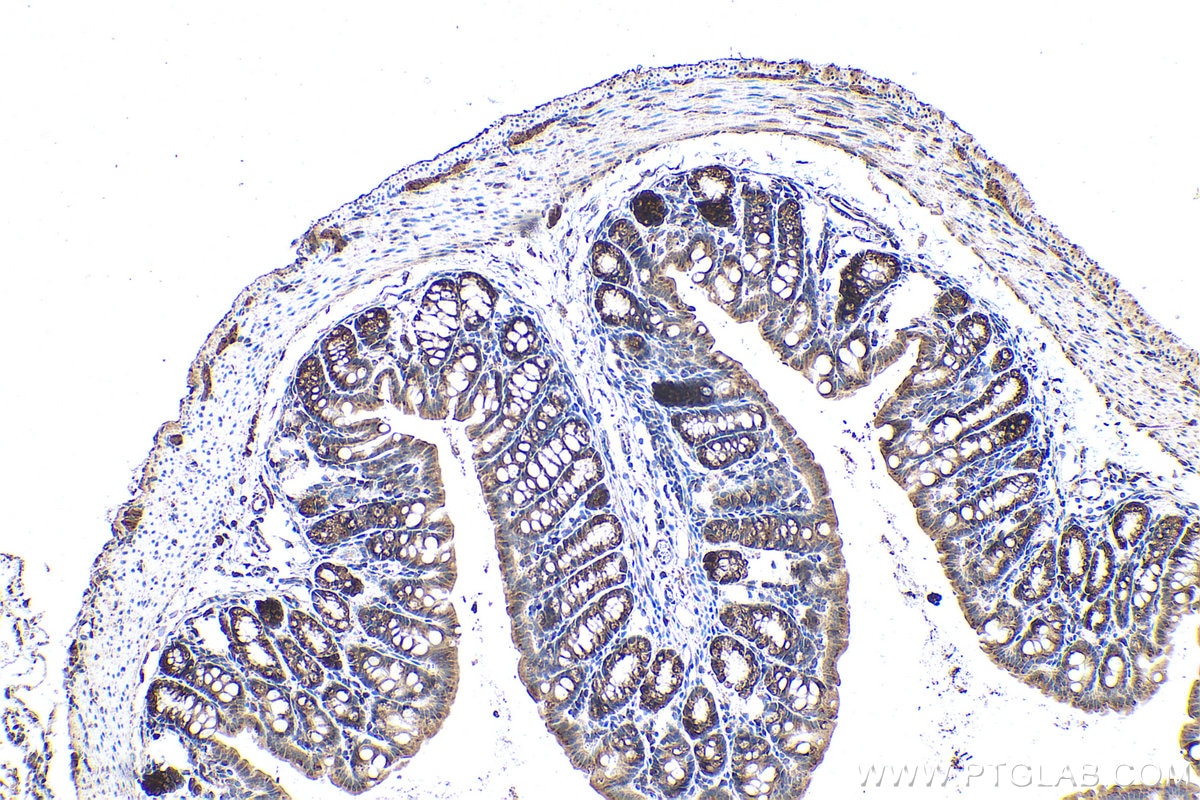 Immunohistochemical analysis of paraffin-embedded mouse colon tissue slide using KHC0980 (ARFIP2 IHC Kit).