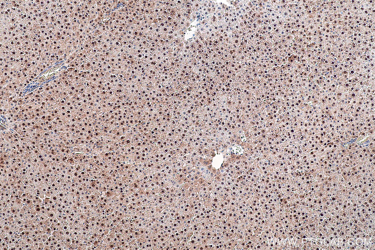 Immunohistochemical analysis of paraffin-embedded rat liver tissue slide using KHC0383 (ARG1 IHC Kit).