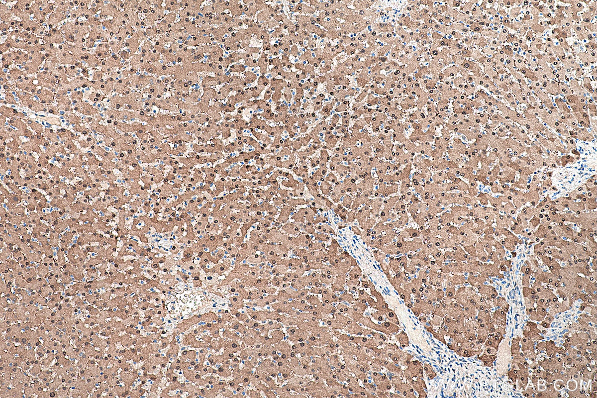 Immunohistochemical analysis of paraffin-embedded human liver tissue slide using KHC0383 (ARG1 IHC Kit).