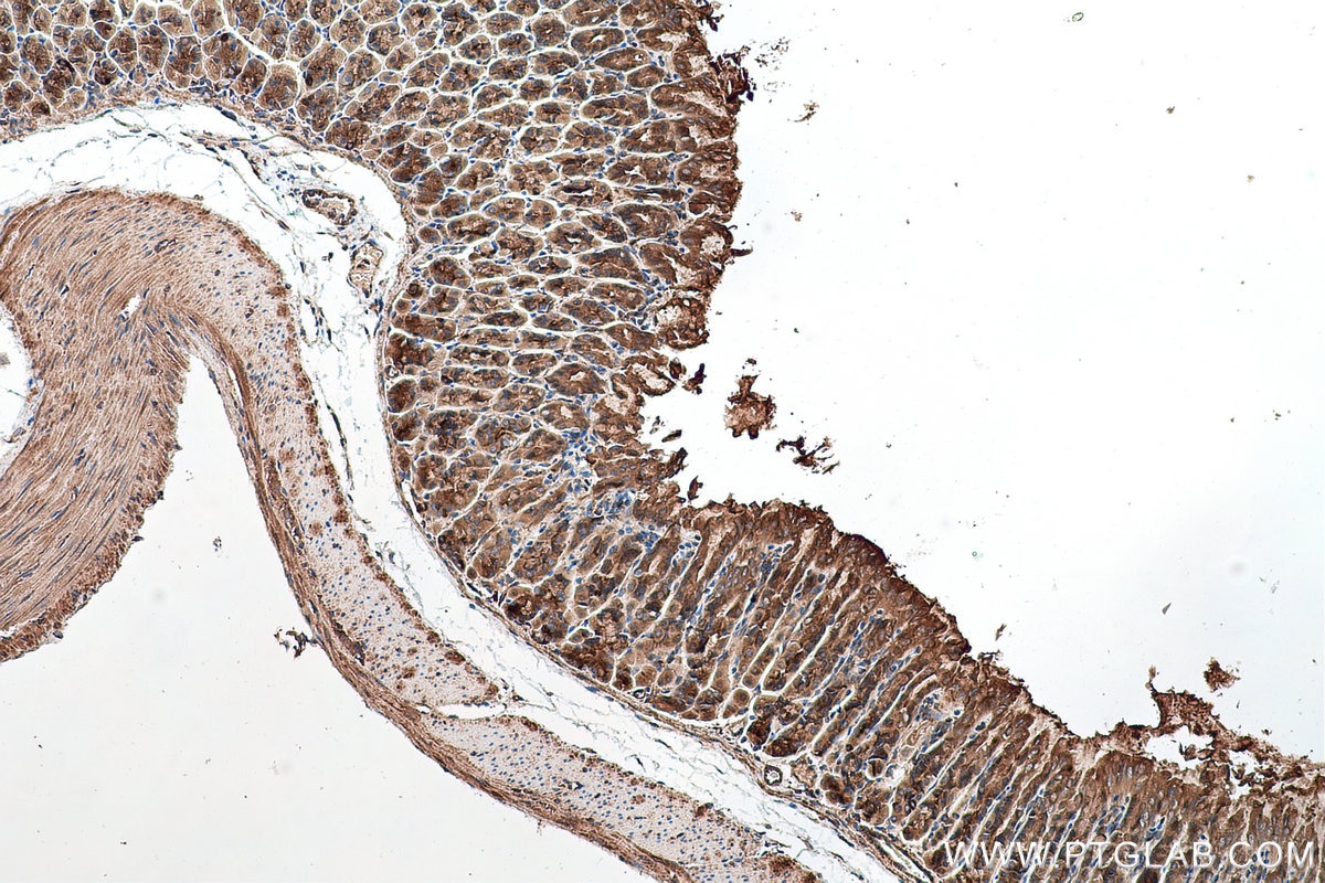 Immunohistochemical analysis of paraffin-embedded mouse stomach tissue slide using KHC0717 (ARHGAP1 IHC Kit).