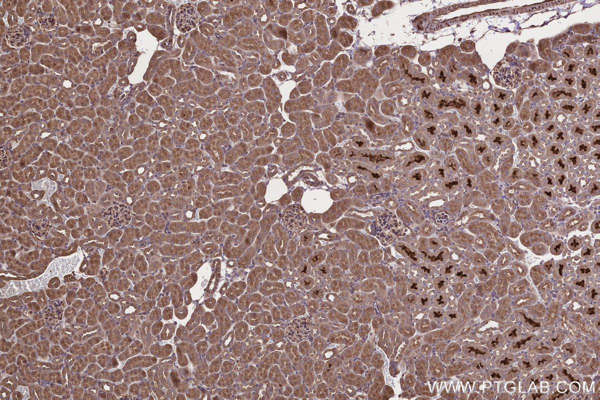 Immunohistochemical analysis of paraffin-embedded mouse kidney tissue slide using KHC2669 (ARHGAP24 IHC Kit).