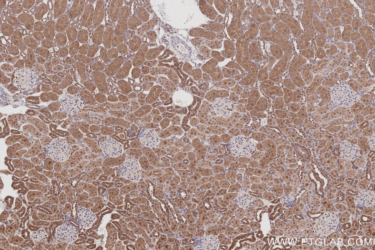 Immunohistochemical analysis of paraffin-embedded rat kidney tissue slide using KHC2994 (ARHGAP28 IHC Kit). Immunohistochemical analysis of paraffin-embedded rat kidney tissue slide using KHC2994 (ARHGAP28 IHC Kit).