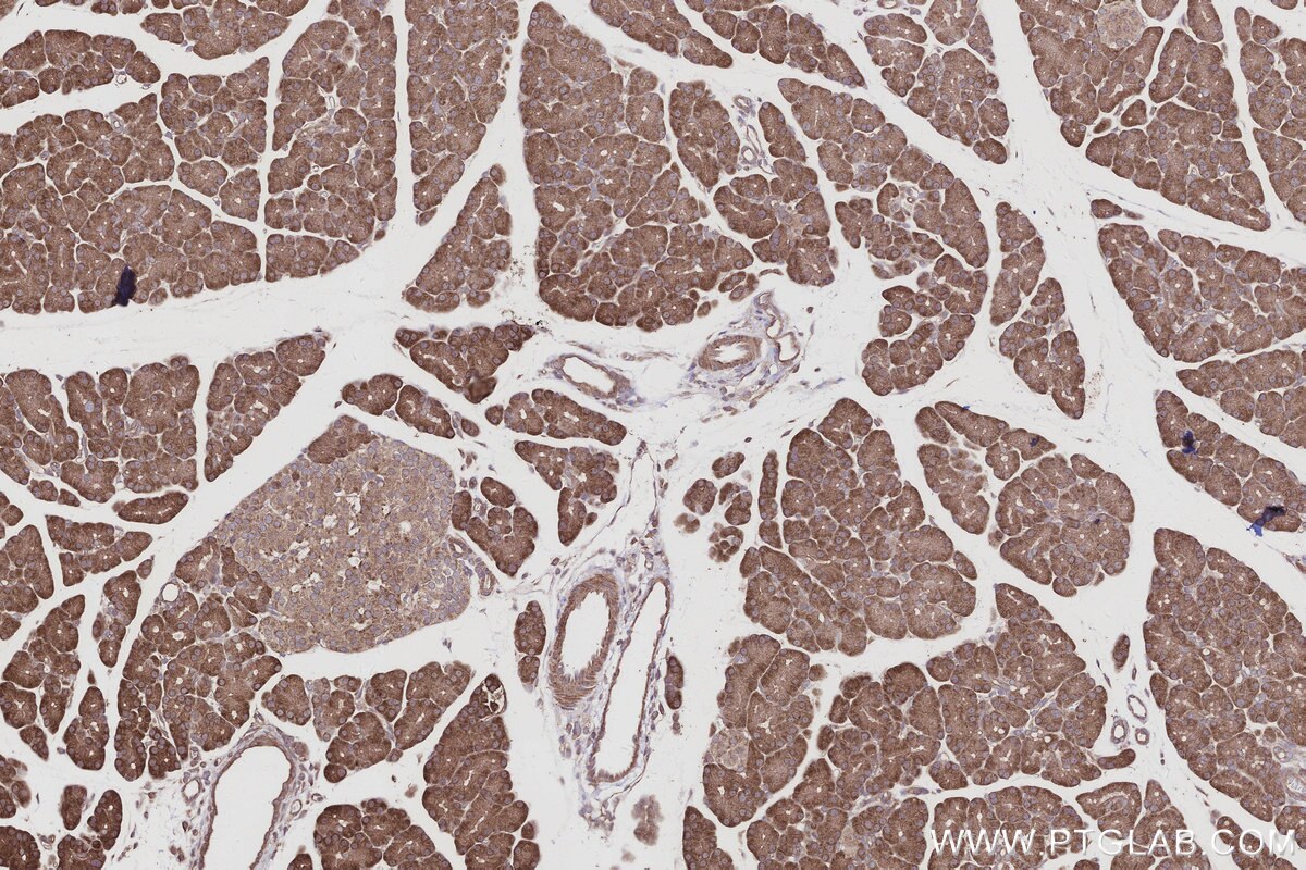 Immunohistochemical analysis of paraffin-embedded rat pancreas tissue slide using KHC2994 (ARHGAP28 IHC Kit). Immunohistochemical analysis of paraffin-embedded rat pancreas tissue slide using KHC2994 (ARHGAP28 IHC Kit).