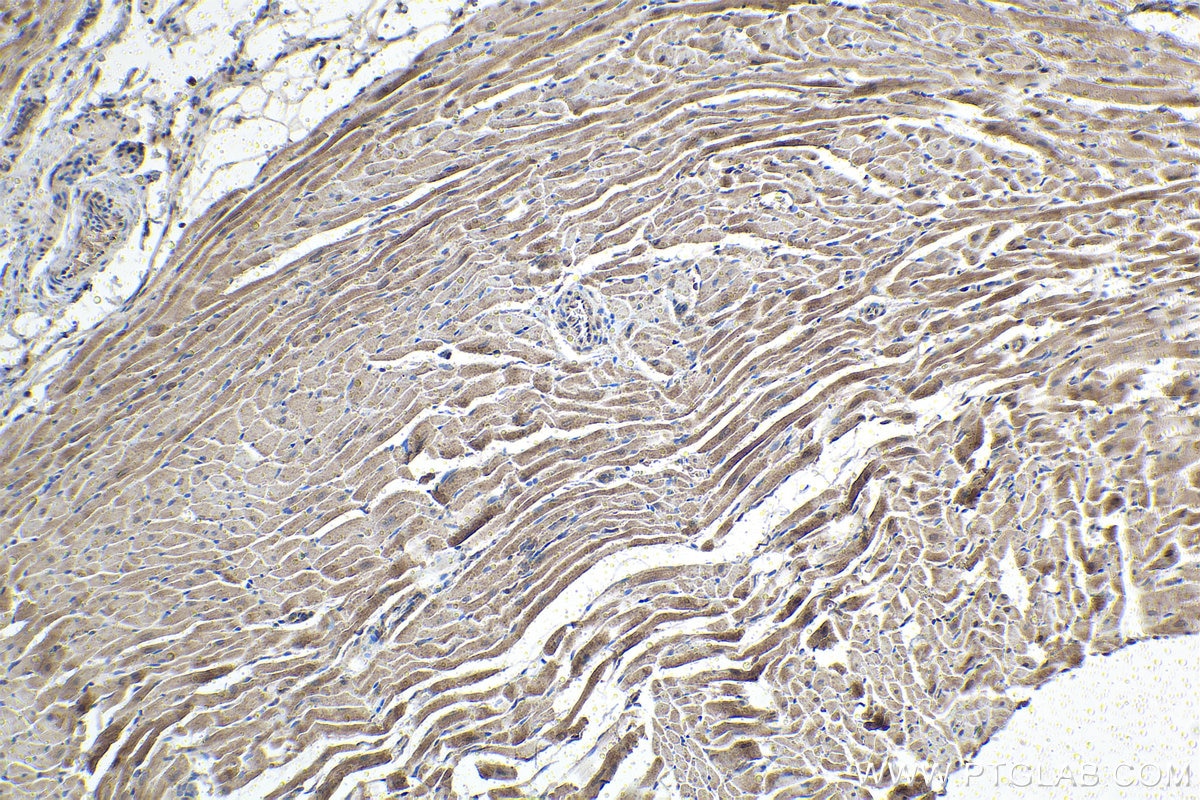 Immunohistochemical analysis of paraffin-embedded rat heart tissue slide using KHC1494 (ARHGAP29 IHC Kit).