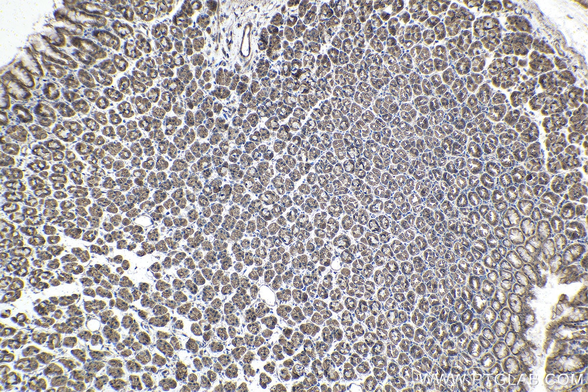 Immunohistochemical analysis of paraffin-embedded rat stomach tissue slide using KHC1494 (ARHGAP29 IHC Kit).