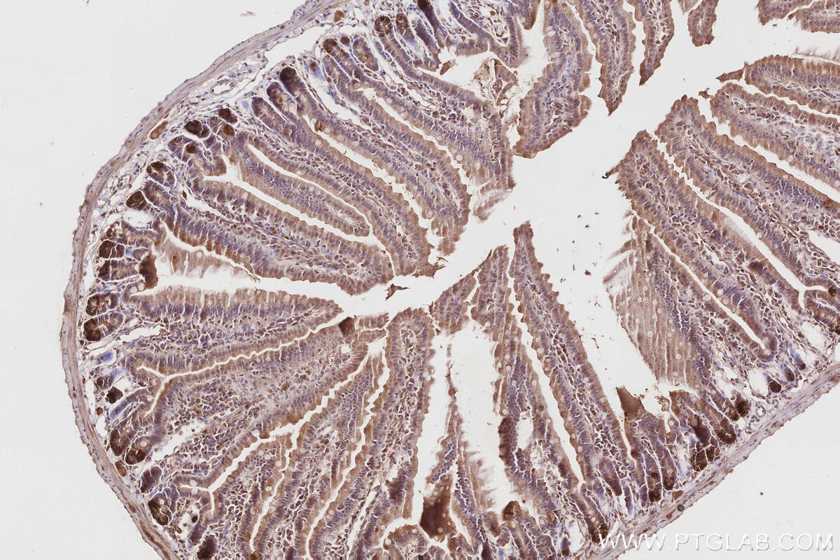 Immunohistochemical analysis of paraffin-embedded mouse small intestine tissue slide using KHC2857 (ARHGAP9 IHC Kit).