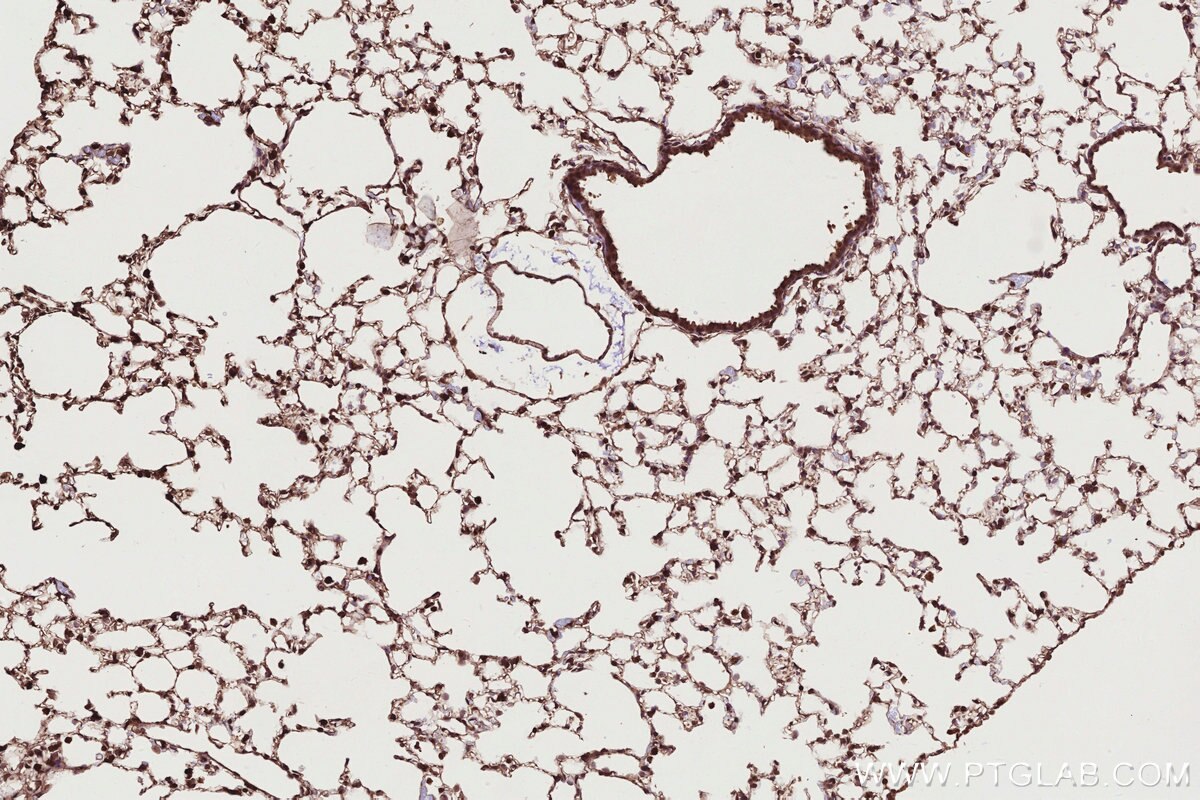 Immunohistochemical analysis of paraffin-embedded mouse lung tissue slide using KHC2764 (ARHGEF1 IHC Kit). Immunohistochemical analysis of paraffin-embedded mouse lung tissue slide using KHC2764 (ARHGEF1 IHC Kit).