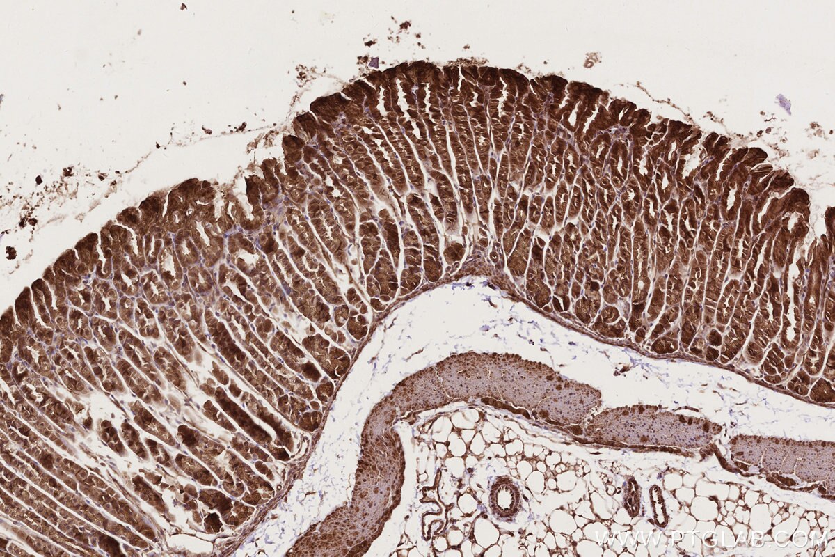 Immunohistochemical analysis of paraffin-embedded mouse stomach tissue slide using KHC2764 (ARHGEF1 IHC Kit). Immunohistochemical analysis of paraffin-embedded mouse stomach tissue slide using KHC2764 (ARHGEF1 IHC Kit).