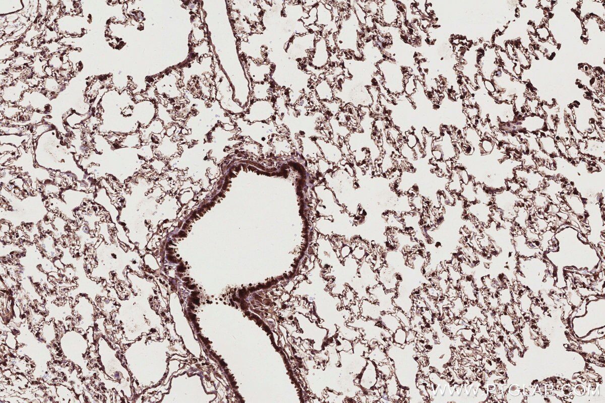 Immunohistochemical analysis of paraffin-embedded rat lung tissue slide using KHC2764 (ARHGEF1 IHC Kit). Immunohistochemical analysis of paraffin-embedded rat lung tissue slide using KHC2764 (ARHGEF1 IHC Kit).