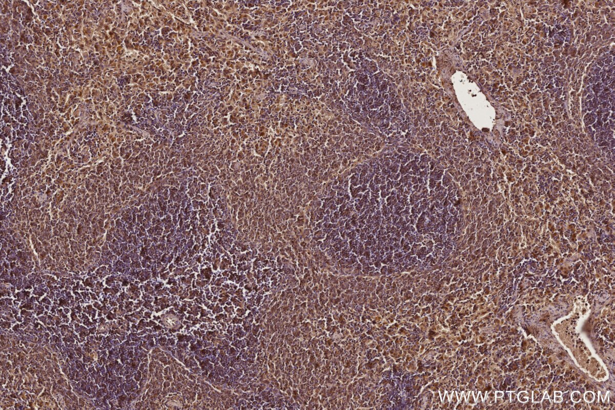 Immunohistochemical analysis of paraffin-embedded rat spleen tissue slide using KHC2764 (ARHGEF1 IHC Kit). Immunohistochemical analysis of paraffin-embedded rat spleen tissue slide using KHC2764 (ARHGEF1 IHC Kit).