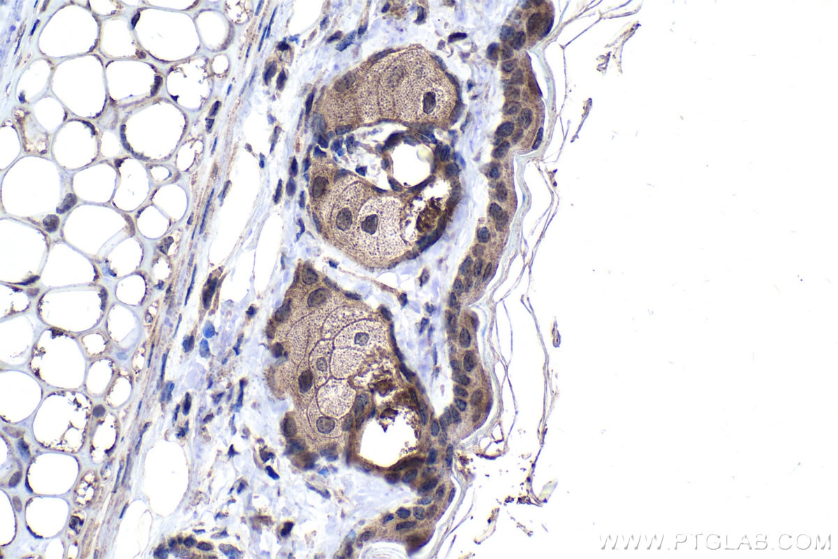 Immunohistochemical analysis of paraffin-embedded mouse skin tissue slide using KHC1690 (ARHGEF5 IHC Kit).