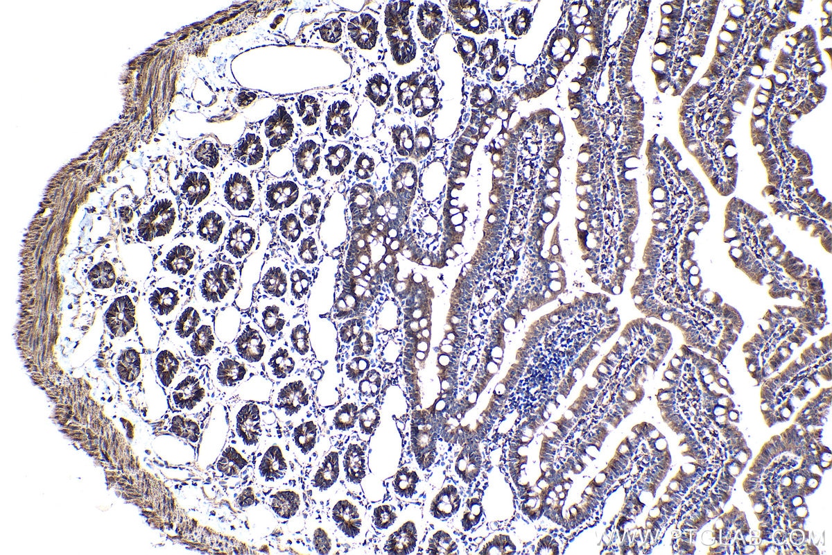 Immunohistochemical analysis of paraffin-embedded rat small intestine tissue slide using KHC1690 (ARHGEF5 IHC Kit).