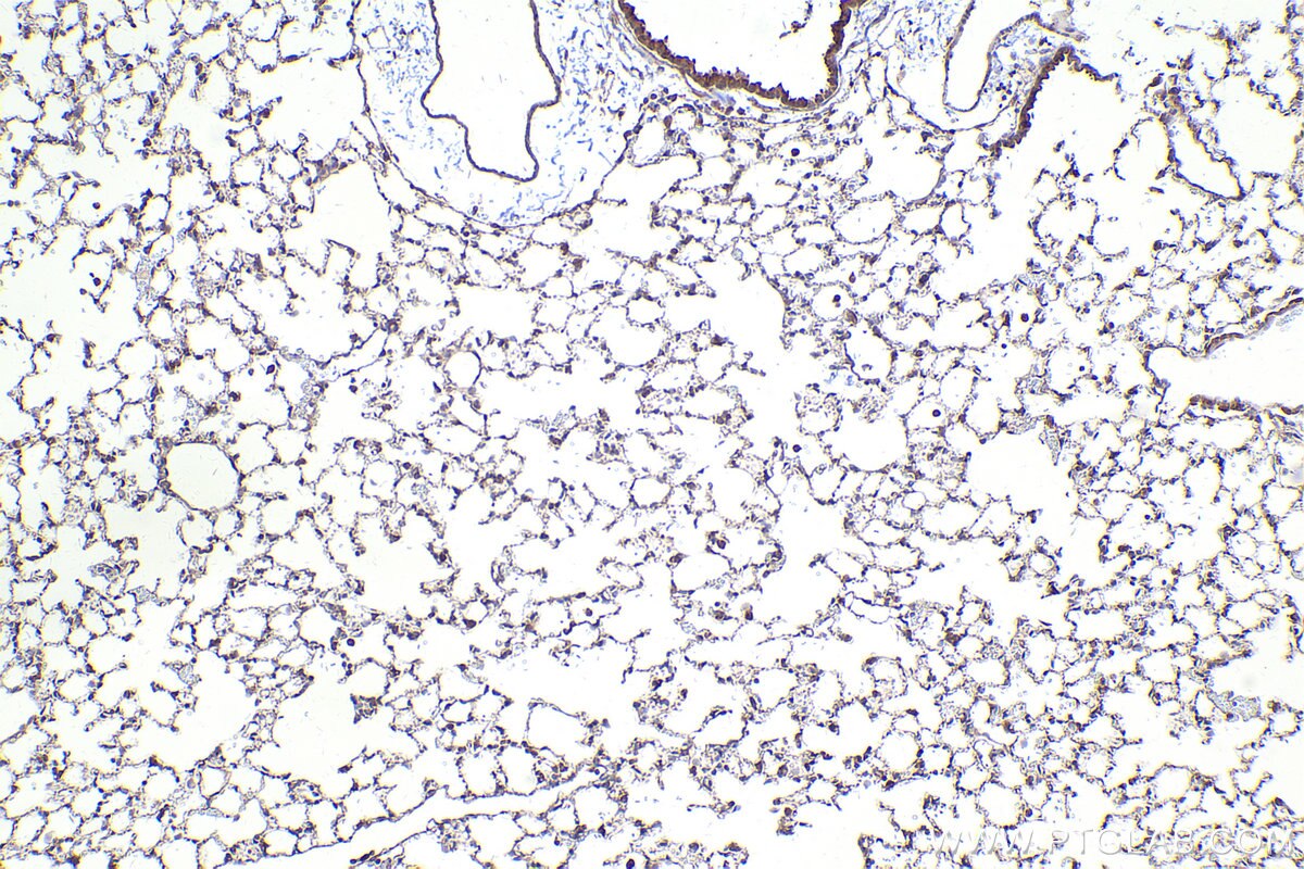 Immunohistochemical analysis of paraffin-embedded mouse lung tissue slide using KHC2449 (ARHGEF7 IHC Kit).
