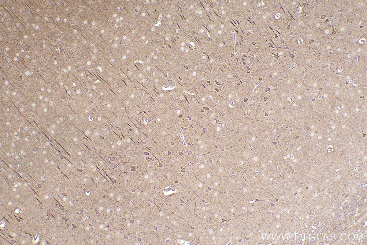 Immunohistochemical analysis of paraffin-embedded rat brain tissue slide using KHC2449 (ARHGEF7 IHC Kit).