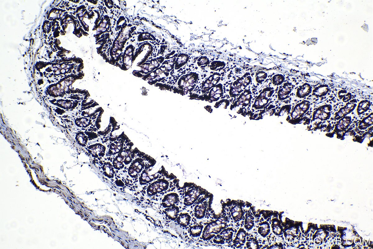 Immunohistochemical analysis of paraffin-embedded rat colon tissue slide using KHC1329 (ARID1A IHC Kit).