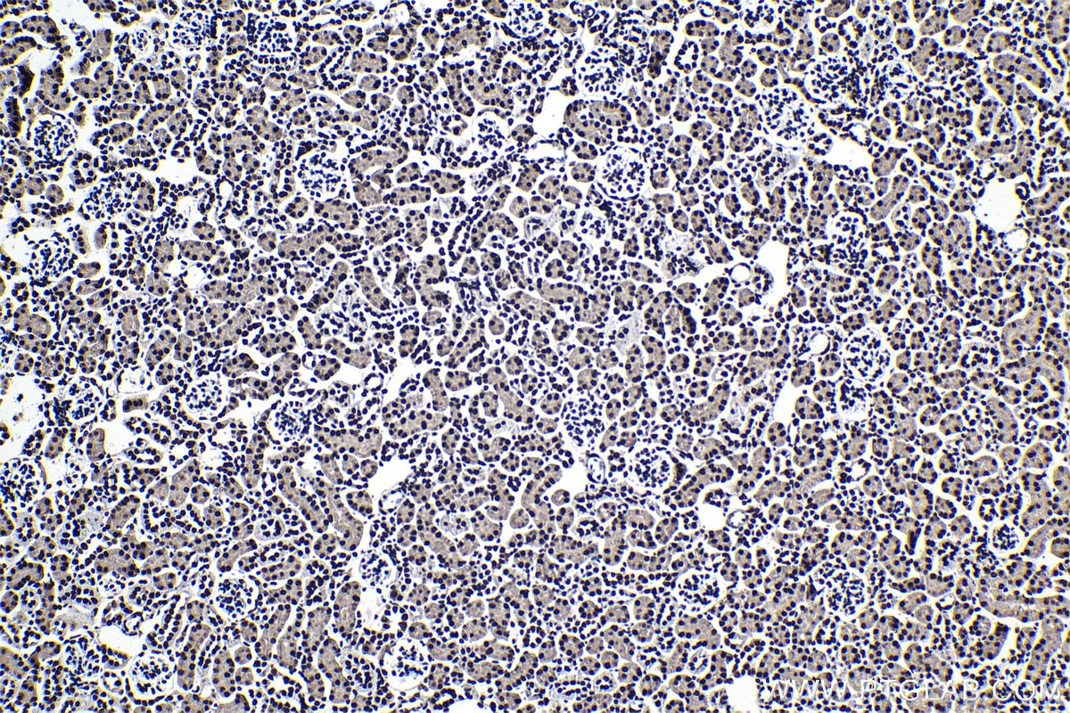 Immunohistochemical analysis of paraffin-embedded mouse kidney tissue slide using KHC1329 (ARID1A IHC Kit).