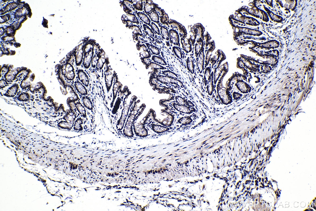 Immunohistochemical analysis of paraffin-embedded mouse colon tissue slide using KHC1329 (ARID1A IHC Kit).