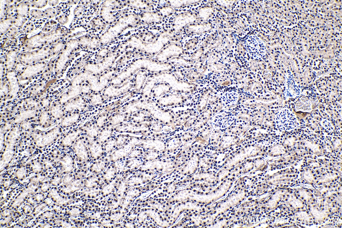 Immunohistochemical analysis of paraffin-embedded rat kidney tissue slide using KHC1329 (ARID1A IHC Kit).