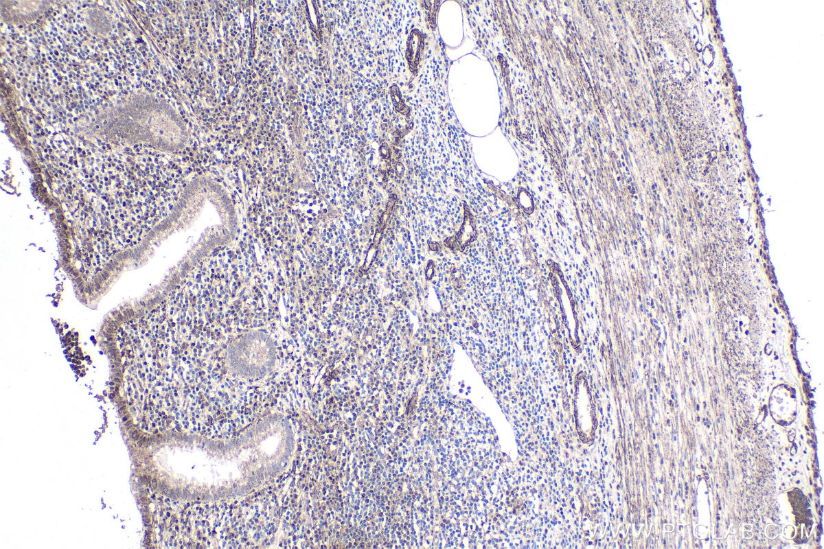 Immunohistochemical analysis of paraffin-embedded human appendicitis tissue slide using KHC1925 (ARID3A IHC Kit).