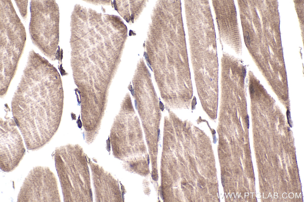 Immunohistochemical analysis of paraffin-embedded mouse skeletal muscle tissue slide using KHC1925 (ARID3A IHC Kit).