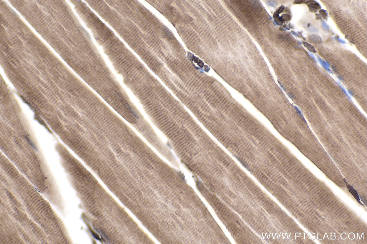 Immunohistochemical analysis of paraffin-embedded rat skeletal muscle tissue slide using KHC1925 (ARID3A IHC Kit).