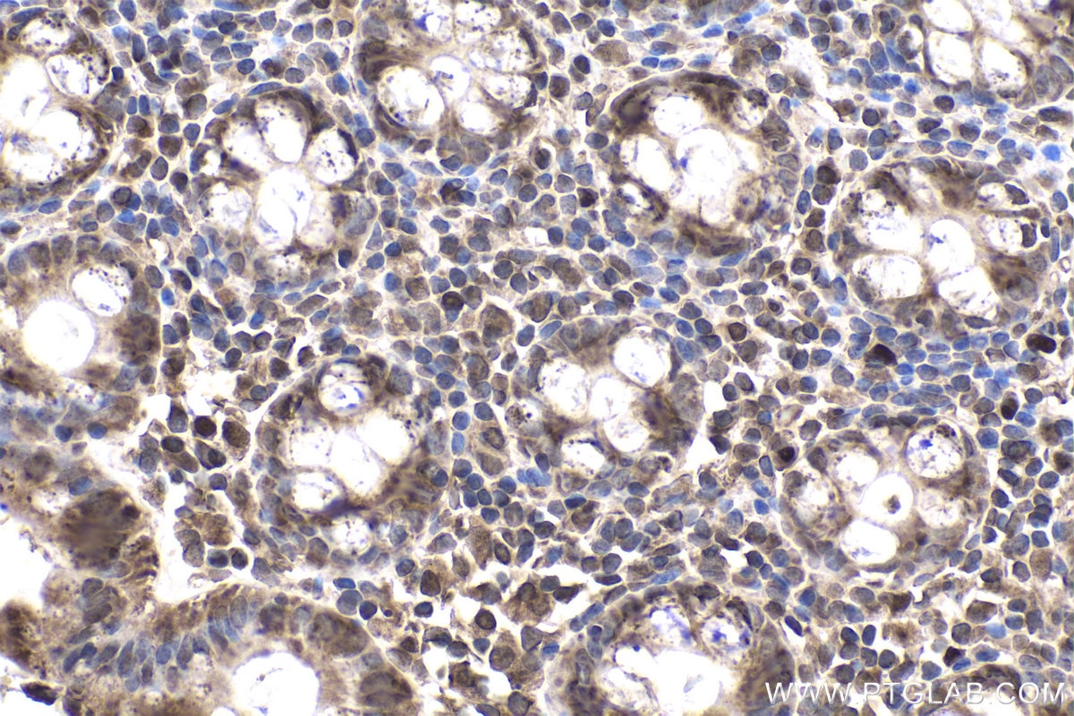Immunohistochemical analysis of paraffin-embedded human colon tissue slide using KHC1925 (ARID3A IHC Kit).