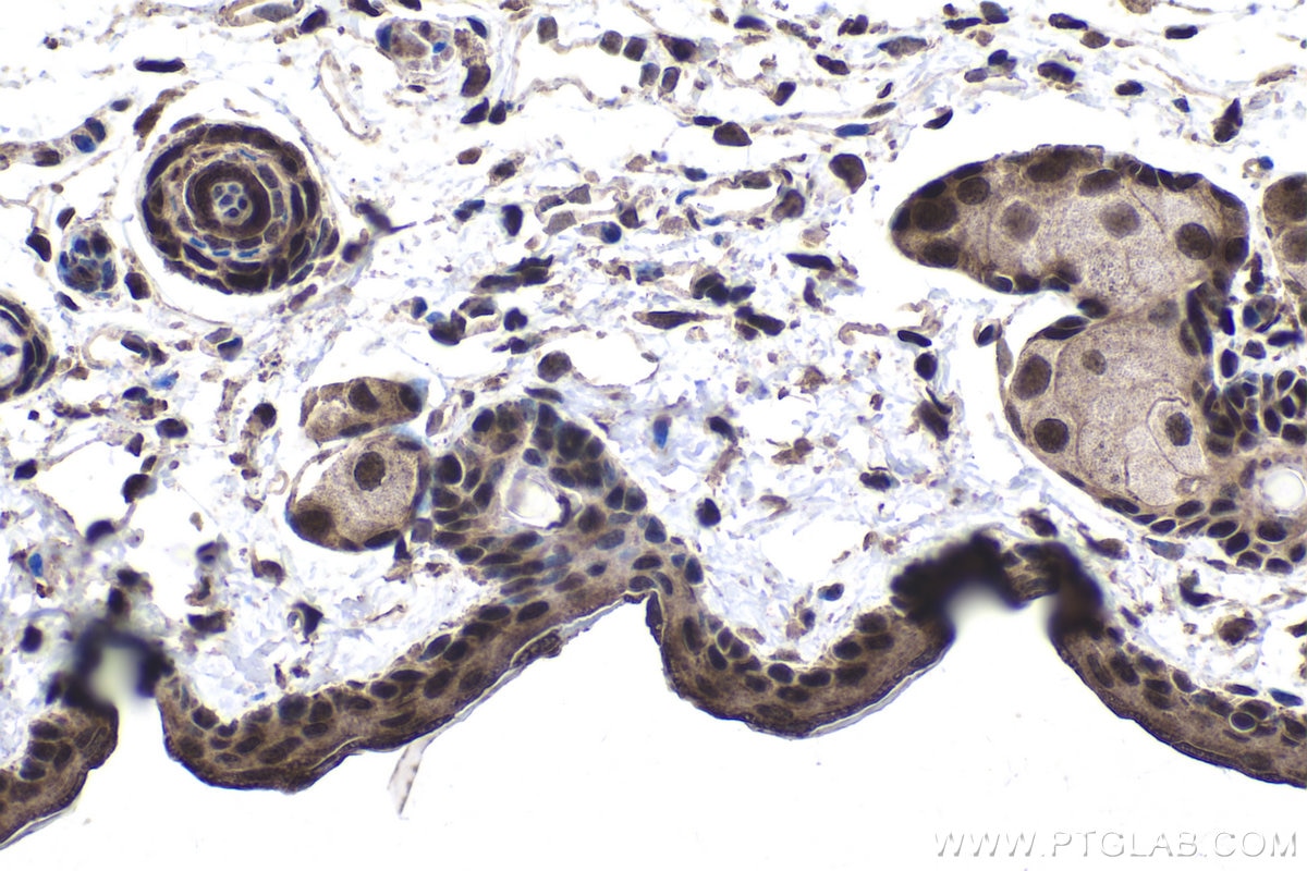 Immunohistochemical analysis of paraffin-embedded mouse skin tissue slide using KHC1772 (ARID4B IHC Kit).