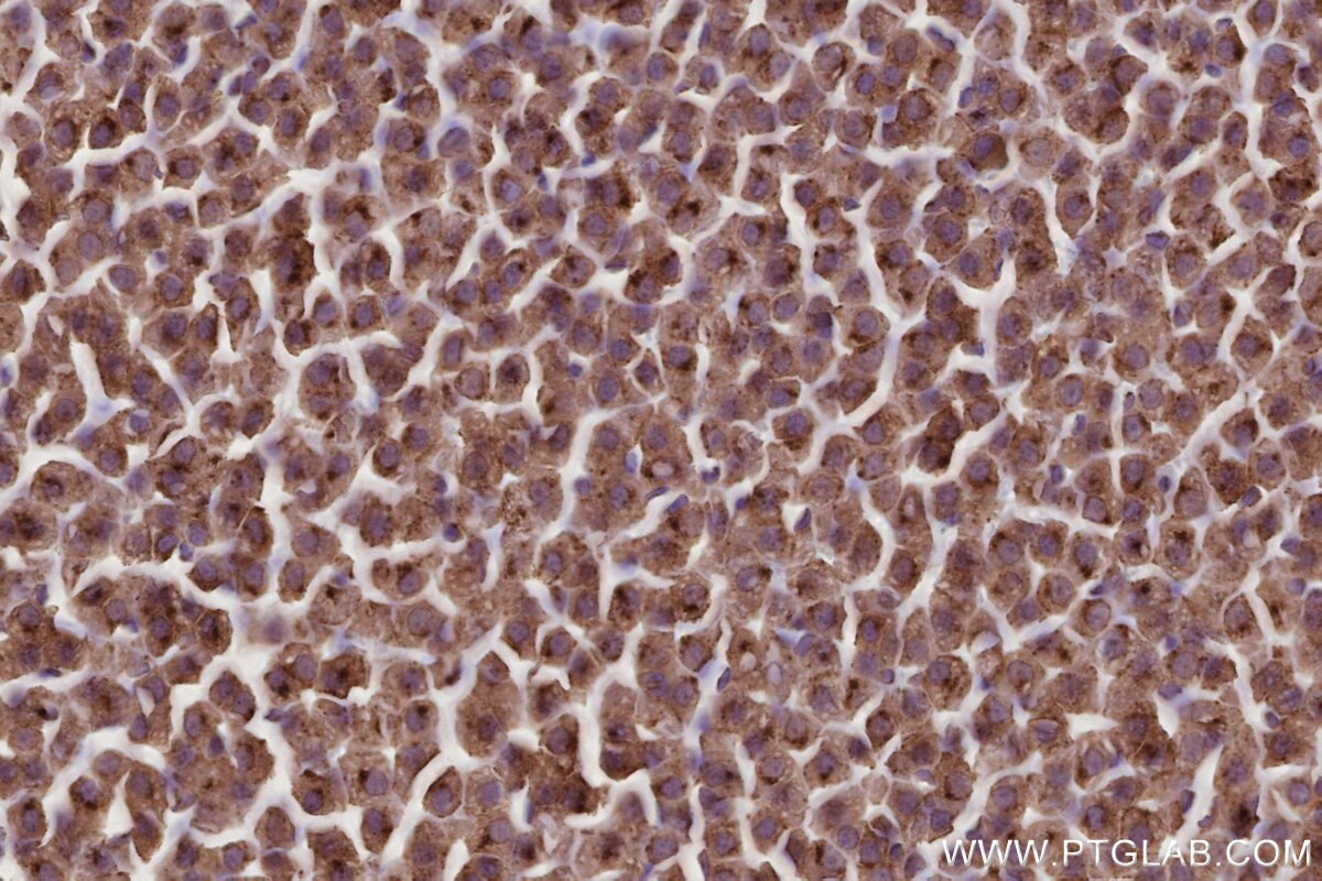 Immunohistochemical analysis of paraffin-embedded rat adrenal gland tissue slide using KHC2779 (ARL8A/ARL8B IHC Kit).