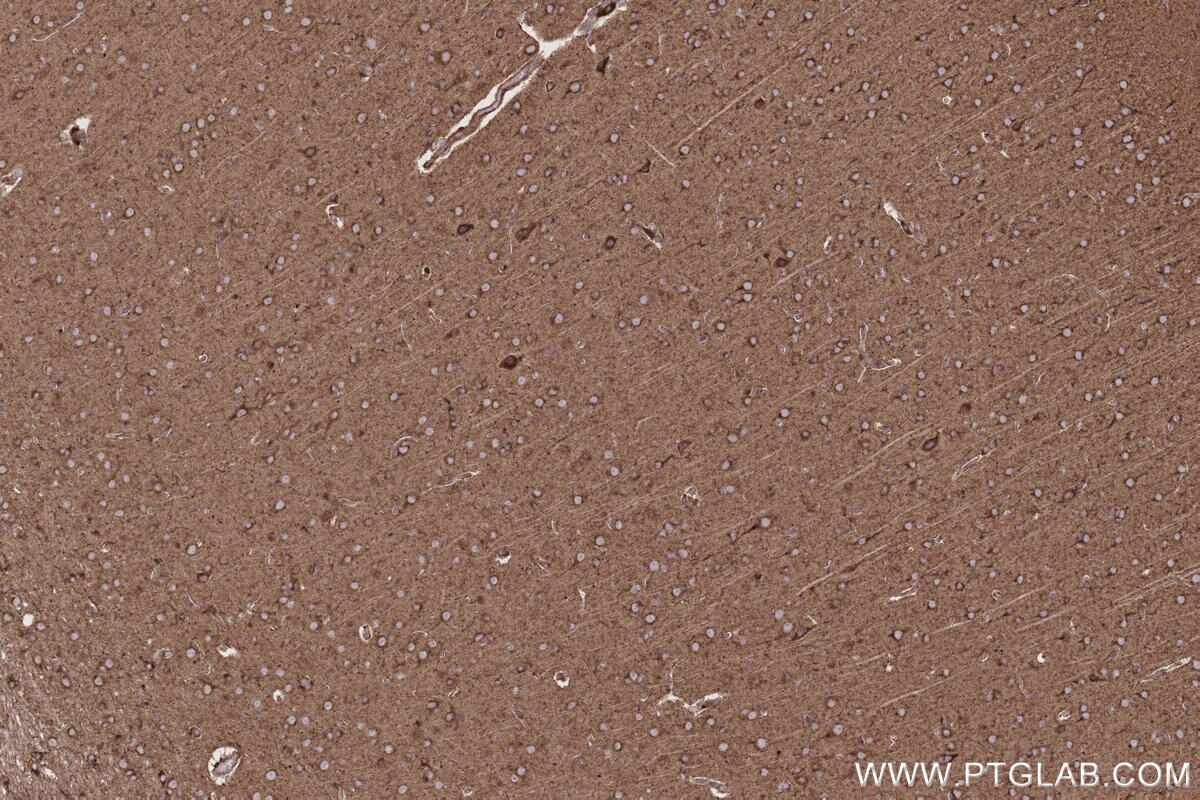 Immunohistochemical analysis of paraffin-embedded rat brain tissue slide using KHC2779 (ARL8A/ARL8B IHC Kit).