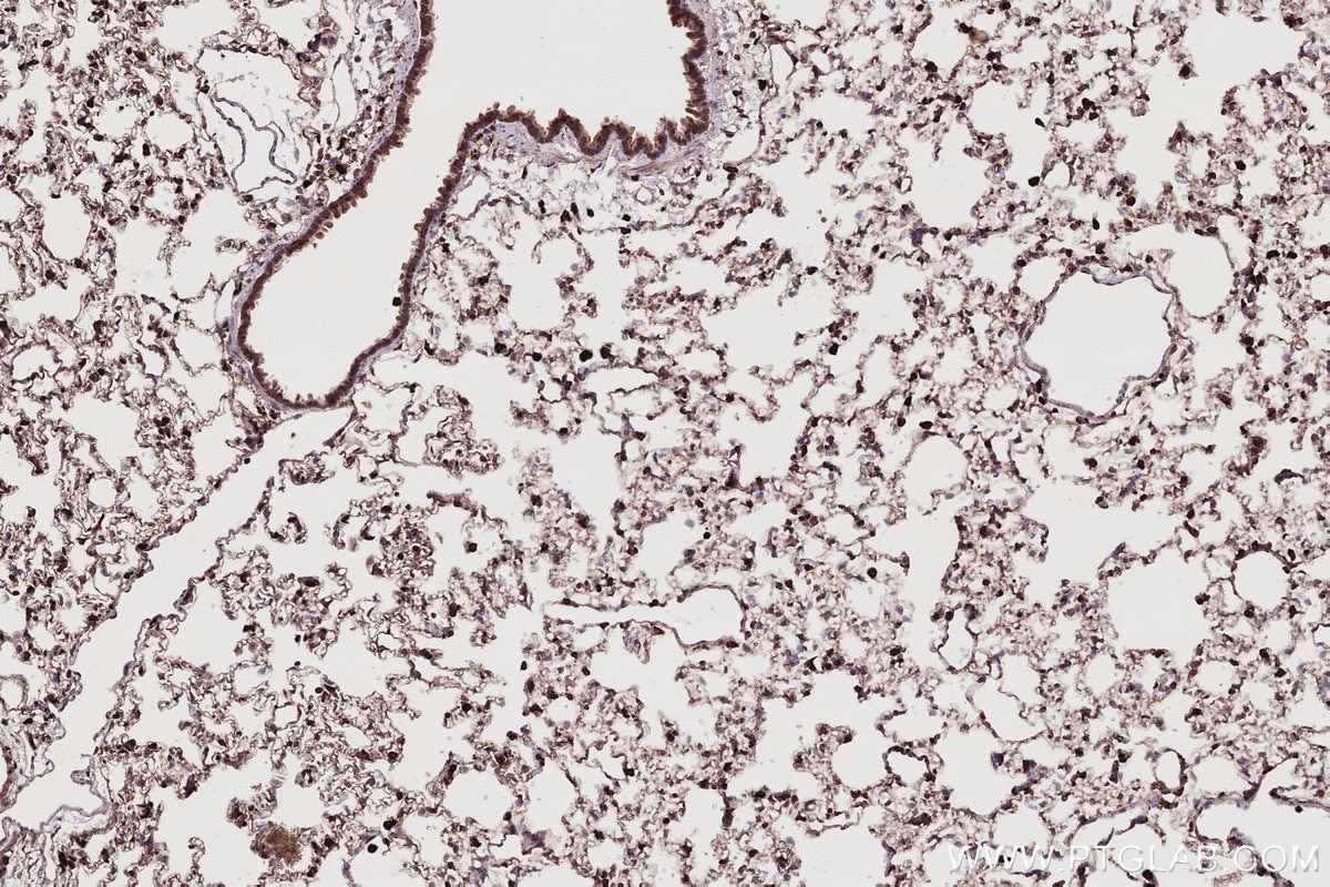 Immunohistochemical analysis of paraffin-embedded rat lung tissue slide using KHC2779 (ARL8A/ARL8B IHC Kit).