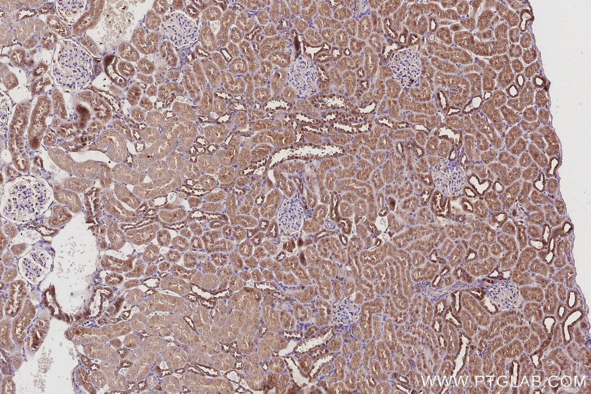Immunohistochemical analysis of paraffin-embedded rat kidney tissue slide using KHC2959 (ARL8B IHC Kit).
