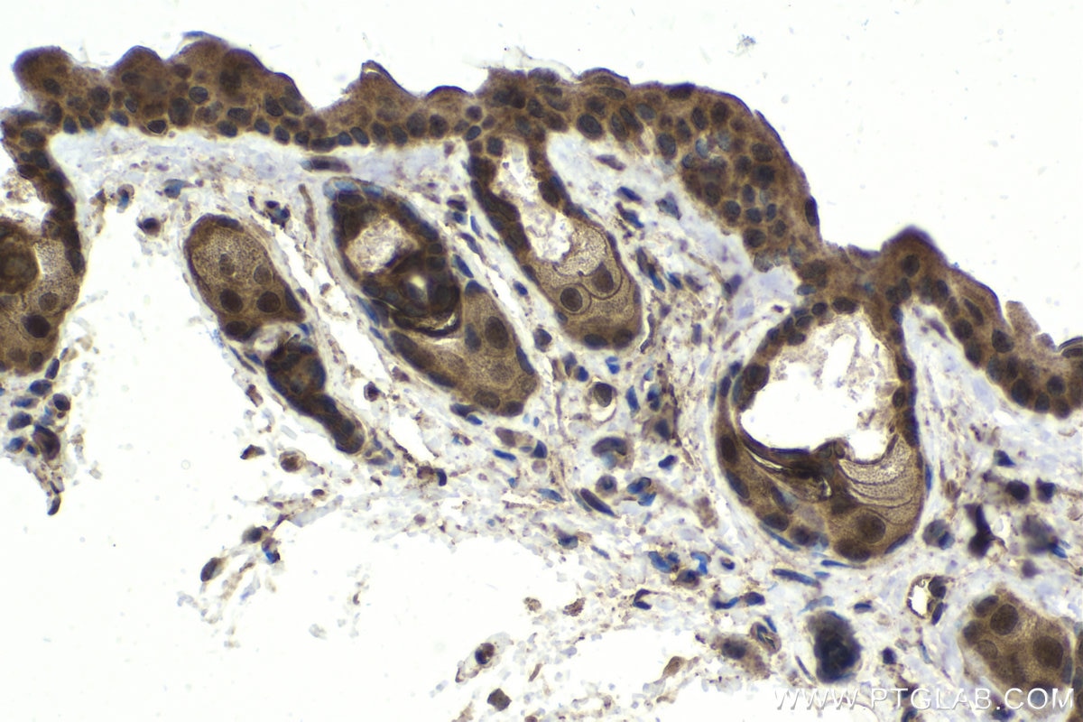 Immunohistochemical analysis of paraffin-embedded mouse skin tissue slide using KHC1817 (ARMC8 IHC Kit).