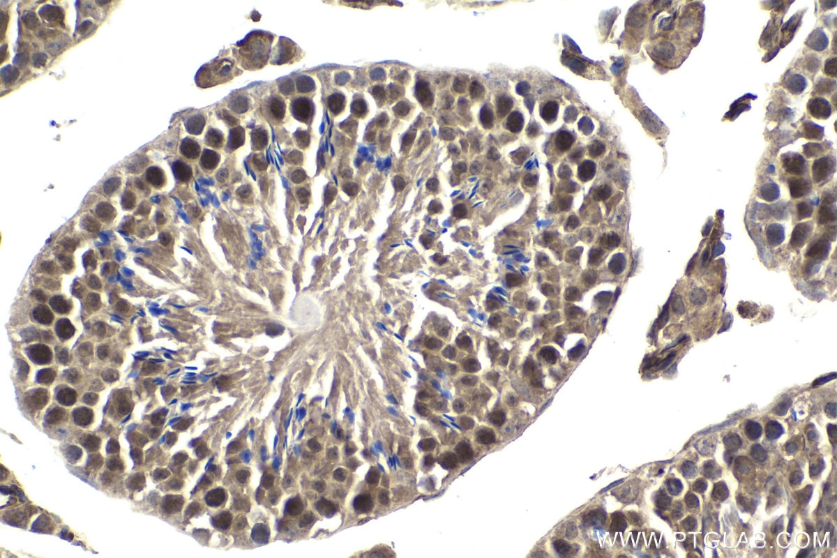 Immunohistochemical analysis of paraffin-embedded mouse testis tissue slide using KHC1817 (ARMC8 IHC Kit).
