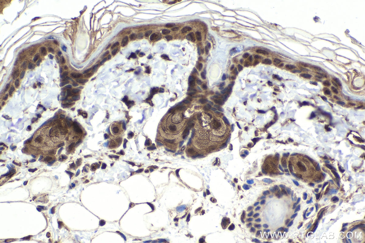 Immunohistochemical analysis of paraffin-embedded rat skin tissue slide using KHC1817 (ARMC8 IHC Kit).