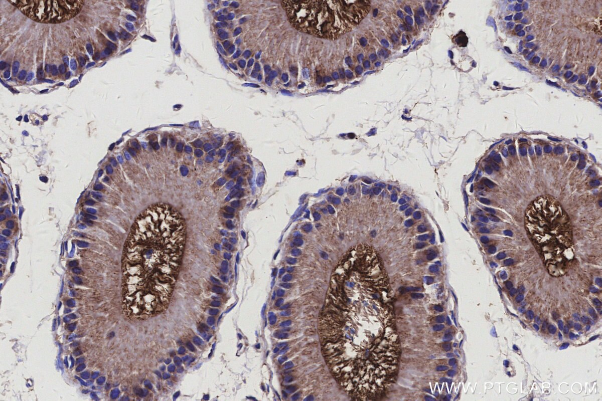 Immunohistochemical analysis of paraffin-embedded mouse epididymis tissue slide using KHC3120 (ARMCX3 IHC Kit). Immunohistochemical analysis of paraffin-embedded mouse epididymis tissue slide using KHC3120 (ARMCX3 IHC Kit).