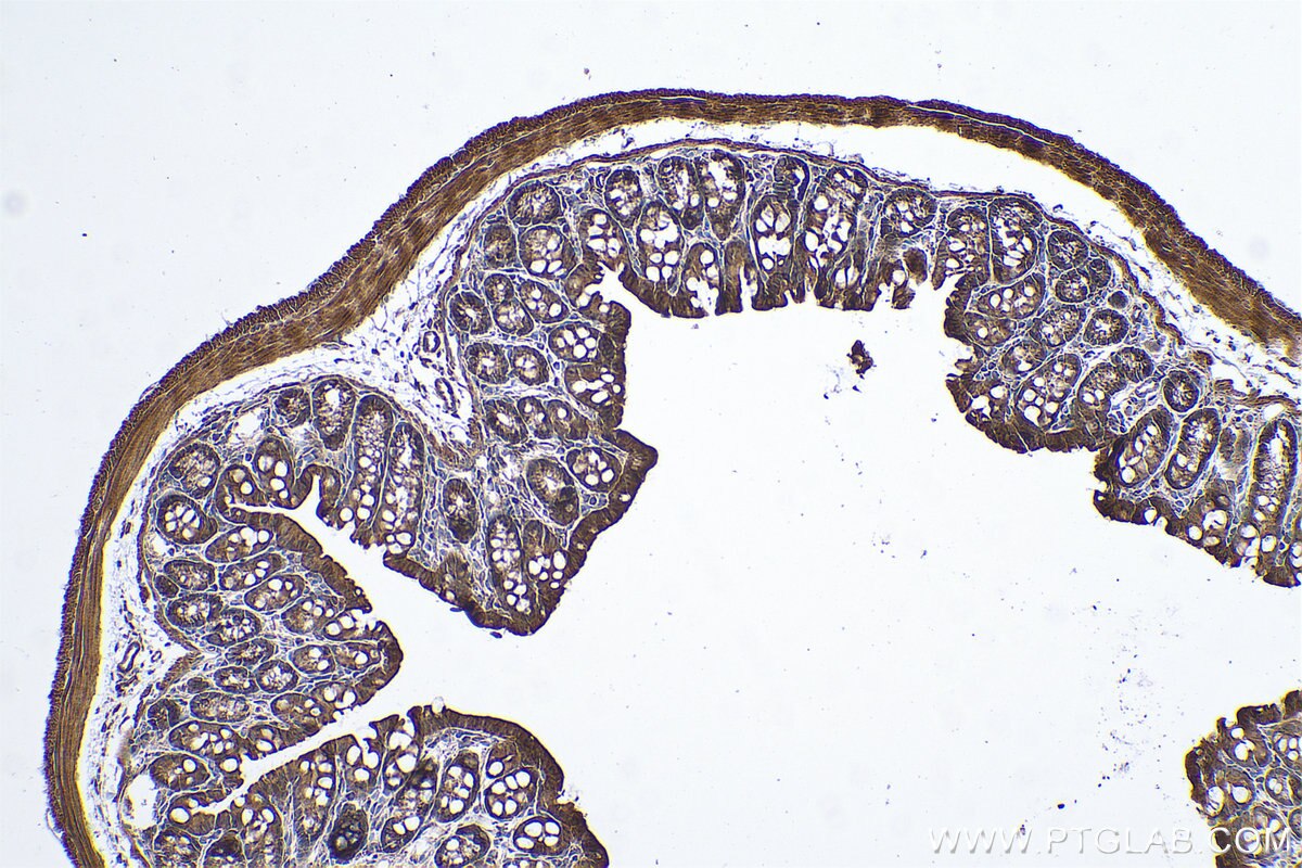 Immunohistochemical analysis of paraffin-embedded mouse colon tissue slide using KHC0686 (ARMET IHC Kit).