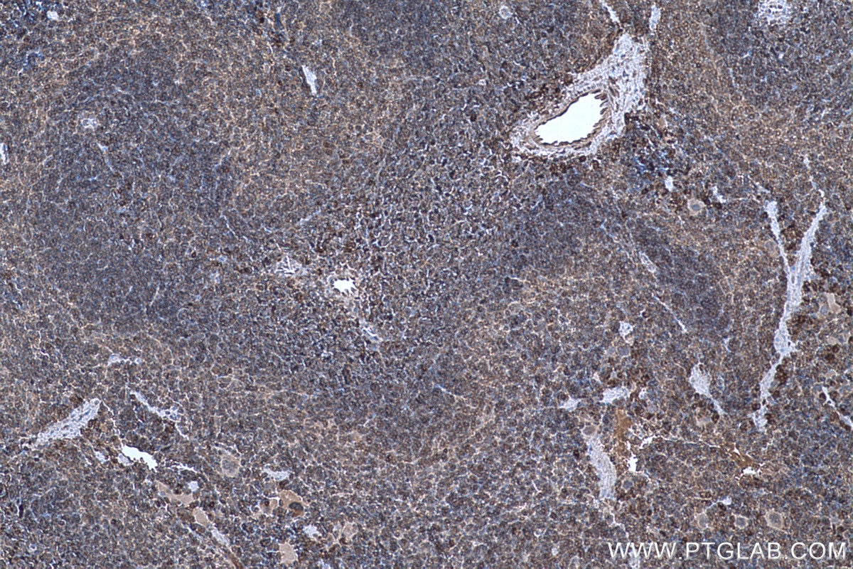 Immunohistochemical analysis of paraffin-embedded mouse spleen tissue slide using KHC0622 (ARPC1B IHC Kit).