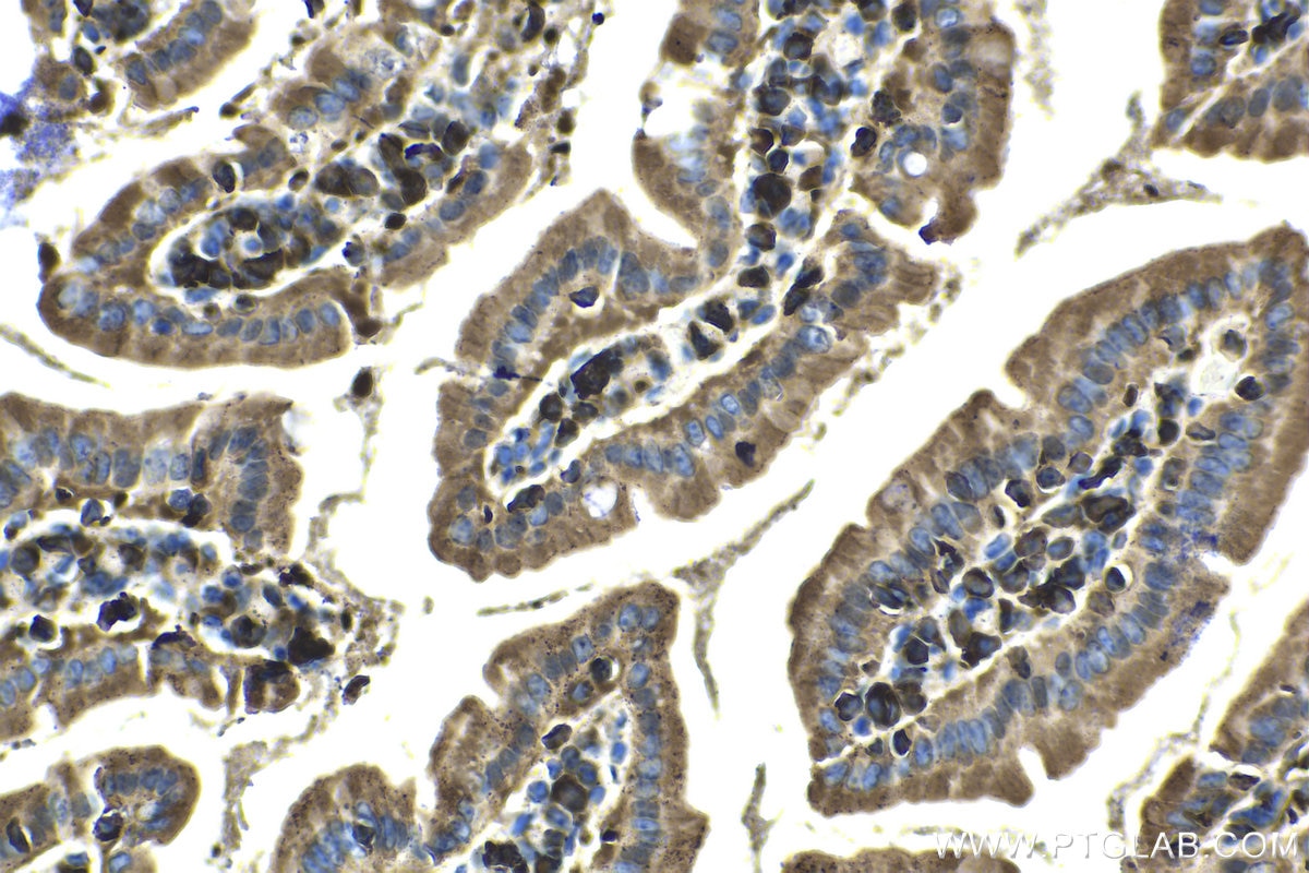 Immunohistochemical analysis of paraffin-embedded mouse small intestine tissue slide using KHC1434 (ARPC2 IHC Kit).